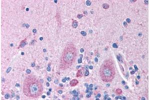 Human Brain, Cerebellum (formalin-fixed, paraffin-embedded) stained with GABRB2 antibody ABIN214759 at 5 ug/ml followed by biotinylated goat anti-rabbit IgG secondary antibody ABIN481713, alkaline phosphatase-streptavidin and chromogen.