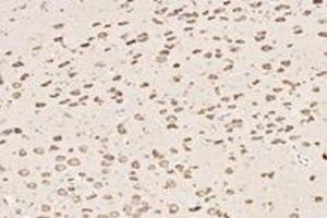 Immunohistochemistry analysis of paraffin-embedded rat substantia nigra using ST8SiaIII (ABIN7075721) at dilution of 1: 4000 (ST8SIA3 抗体)