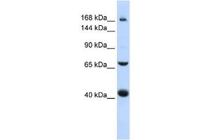 Western Blotting (WB) image for anti-ATP-Binding Cassette, Sub-Family C (CFTR/MRP), Member 9 (ABCC9) (Middle Region) antibody (ABIN2781513)