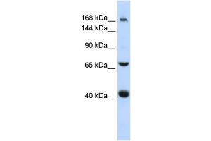 WB Suggested Anti-ABCC9 Antibody Titration:  0. (ABCC9 抗体  (Middle Region))