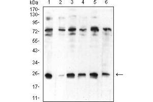 Western Blotting (WB) image for anti-Chromobox Homolog 5 (CBX5) (AA 1-191) antibody (ABIN5542711)