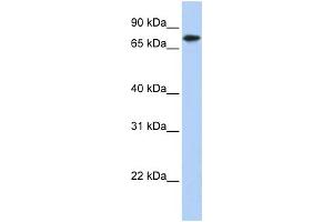 WB Suggested Anti-KLHL23 Antibody Titration: 0. (KLHL23 抗体  (Middle Region))