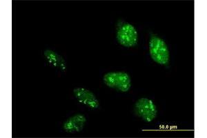 Immunofluorescence (IF) image for anti-Polymerase (RNA) I Polypeptide D, 16kDa (POLR1D) (AA 1-133) antibody (ABIN949280)