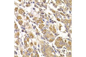 Immunohistochemistry of paraffin-embedded human stomach using METTL7B antibody (ABIN5974333) at dilution of 1/100 (40x lens). (METTL7B 抗体)