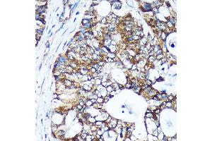 Immunohistochemistry (IHC) image for anti-GULP, Engulfment Adaptor PTB Domain Containing 1 (GULP1) (AA 1-130) antibody (ABIN6141541)