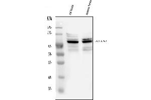 Western blot analysis of Ataxin 1 using anti-Ataxin 1 antibody (ABIN3043506).