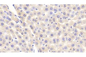 Detection of SAP in Rat Liver Tissue using Polyclonal Antibody to Serum Amyloid P Component (SAP) (APCS 抗体  (AA 22-222))