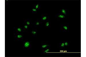 Immunofluorescence (IF) image for anti-CCAAT/enhancer Binding Protein (C/EBP), zeta (CEBPZ) (AA 1-1054) antibody (ABIN523531)