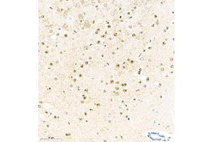 Immunohistochemistry analysis of paraffin embedded mouse brain using KCNIP3 (ABIN7073771) at dilution of 1: 2000 (DREAM 抗体)