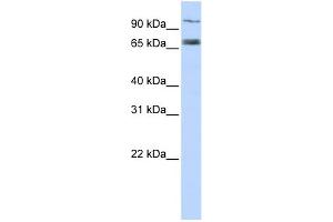 WB Suggested Anti-TAP1 Antibody Titration:  0. (TAP1 抗体  (Middle Region))
