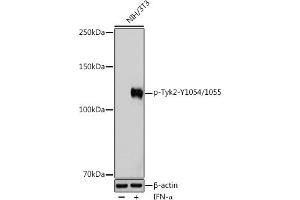 Western blot analysis of extracts of NIH/3T3 cells, using Phospho-Tyk2-Y1054/1055 Rabbit pAb (ABIN6135332, ABIN6136278, ABIN6136279 and ABIN6225571) at 1:1000 dilution. (TYK2 抗体  (pTyr1054, pTyr1055))