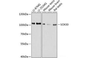 Western blot analysis of extracts of various cell lines using SOX30 Polyclonal Antibody at dilution of 1:1000. (SOX30 抗体)