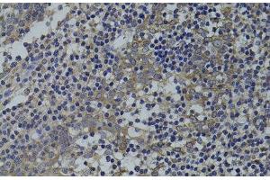 Immunohistochemistry of paraffin-embedded Human tonsil using GNA15 Polyclonal Antibody at dilution of 1:100 (40x lens). (GNA15 抗体)