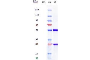 Anti-IL-23a Reference Antibody (risankizumab) on SDS-PAGE under reducing (R) condition. (Recombinant IL23A (Risankizumab Biosimilar) 抗体)