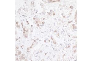 anti-Chromodomain Helicase DNA Binding Protein 8 (CHD8) (AA 2252-2302) antibody