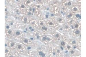 Detection of KATNA1 in Mouse Liver Tissue using Polyclonal Antibody to Katanin P60 Subunit A 1 (KATNA1) (KATNA1 抗体  (AA 260-491))