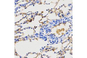 Immunohistochemistry (IHC) image for anti-Neuropeptide Y (NPY) (AA 1-97) antibody (ABIN3017529) (NPY 抗体  (AA 1-97))