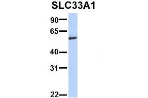Host:  Rabbit  Target Name:  WT1  Sample Type:  721_B  Antibody Dilution:  1. (SLC33A1 抗体  (Middle Region))