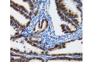 Immunohistochemistry of paraffin-embedded Rat fallopian tube using HSPH1 Polyclonal Antibody at dilution of 1:100 (40x lens). (HSPH1 抗体)