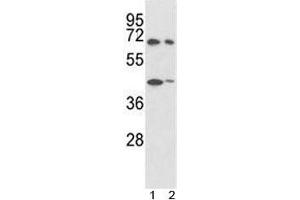 Western blot analysis of SHP2 antibody and 1) 293, 2) K562 lysate. (PTPN11 抗体  (AA 526-551))