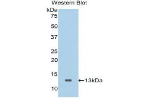 Western Blotting (WB) image for anti-Secreted Frizzled-Related Protein 4 (SFRP4) (AA 265-346) antibody (ABIN1176502) (SFRP4 抗体  (AA 265-346))