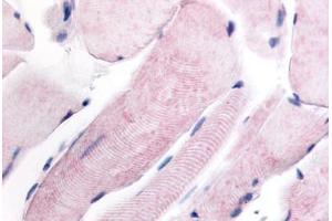 Human Skeletal Muscle (formalin-fixed, paraffin-embedded) stained with WNK1 antibody ABIN213554 at 4 ug/ml followed by biotinylated goat anti-rabbit IgG secondary antibody ABIN481713, alkaline phosphatase-streptavidin and chromogen. (WNK1 抗体  (Internal Region))