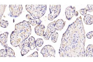 Detection of INSR in Human Placenta Tissue using Monoclonal Antibody to Insulin Receptor (INSR) (Insulin Receptor 抗体)