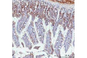 IHC analysis of BCMA using anti-BCMA antibody (ABIN5692956).