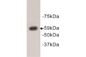 Western Blotting (WB) image for anti-Autoimmune Regulator (AIRE) antibody (ABIN1854830) (AIRE 抗体)
