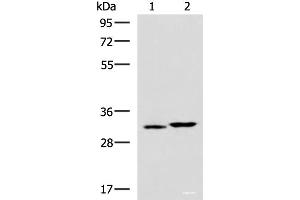 Western blot analysis of 293T cell lysates using CBR3 Polyclonal Antibody at dilution of 1:800 (CBR3 抗体)