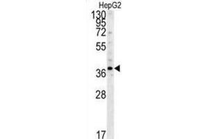 Western Blotting (WB) image for anti-Proteasome (Prosome, Macropain) 26S Subunit, Non-ATPase, 7 (PSMD7) antibody (ABIN3001711) (PSMD7 抗体)