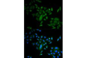 Immunofluorescence analysis of A549 cell using CASP9 antibody. (Caspase 9 抗体)