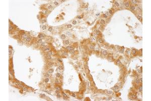 Immunohistochemistry (IHC) image for anti-Coiled-Coil and C2 Domain Containing 1A (CC2D1A) (AA 1-50) antibody (ABIN7448937)