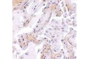 Immunohistochemistry of CAPN6 in human lung tissue with CAPN6 antibody at 2. (Calpain 6 抗体  (C-Term))