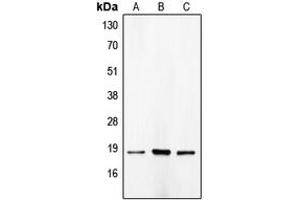 Western blot analysis of p18 INK4c expression in HeLa (A), NIH3T3 (B), COLO205 (C) whole cell lysates. (CDKN2C 抗体  (C-Term))