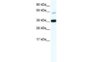 WB Suggested Anti-RELB Antibody Titration:  2. (RELB 抗体  (Middle Region))