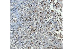 IHC analysis of Chromogranin A/CHGA using anti-Chromogranin A/CHGA antibody (ABIN7600415).