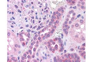 Immunohistochemistry (IHC) image for anti-V-Maf Musculoaponeurotic Fibrosarcoma Oncogene Homolog (Avian) (MAF) (N-Term) antibody (ABIN501710) (MAF 抗体  (N-Term))