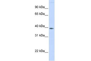 WB Suggested Anti-FAM76B Antibody Titration: 0. (FAM76B 抗体  (Middle Region))