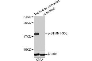 Western blot analysis of extracts of K-562 cells, using Phospho-STMN1-S38 antibody (ABIN2987644). (Stathmin 1 抗体  (pSer38))