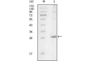 Western Blot showing ITK antibody used against truncated Trx-ITK recombinant protein (1). (ITK 抗体  (AA 2-110))