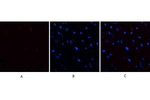 Immunofluorescence analysis of rat heart tissue. (E2F1 抗体  (AA 100-170))