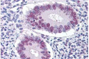 Human Uterus: Formalin-Fixed, Paraffin-Embedded (FFPE) (STK17A 抗体  (AA 301-414))