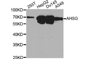 Western blot analysis of extracts of various cell lines, using AHSG antibody. (Fetuin A 抗体)