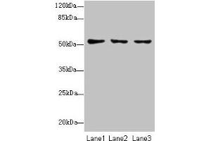 Western blot All lanes: SLC46A2 antibody at 8 μg/mL Lane 1: HT29 whole cell lysate Lane 2: Mouse liver tissue Lane 3: Mouse kidney tissue Secondary Goat polyclonal to rabbit IgG at 1/10000 dilution Predicted band size: 52 kDa Observed band size: 52 kDa (SLC46A2 抗体  (AA 45-78))