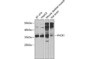Western blot analysis of extracts of various cell lines, using PYCR1 antibody (ABIN6133044, ABIN6146518, ABIN6146520 and ABIN6222710) at 1:1000 dilution. (PYCR1 抗体  (AA 1-319))