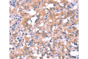 Immunohistochemistry (IHC) image for anti-FAT Tumor Suppressor Homolog 1 (FAT1) antibody (ABIN2434638) (FAT1 抗体)