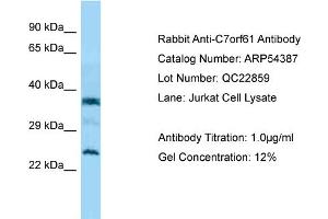 Western Blotting (WB) image for anti-Chromosome 7 Open Reading Frame 61 (C7orf61) (C-Term) antibody (ABIN2785686) (C7orf61 抗体  (C-Term))