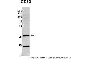 Sample Type: mouse fibroblast lusate (20ug)Primary Dilution: 1:800 (2% milk)Secondary Dilution: 1:2000 (5% milk)Image Submitted By: Anonymous researcher . (CD63 抗体  (C-Term))