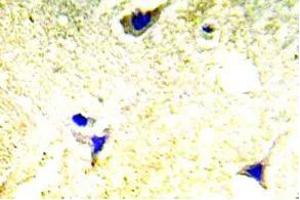 Immunohistochemistry (IHC) analyzes of PAK1/2 antibody in paraffin-embedded human brain tissue. (PAK1 抗体)